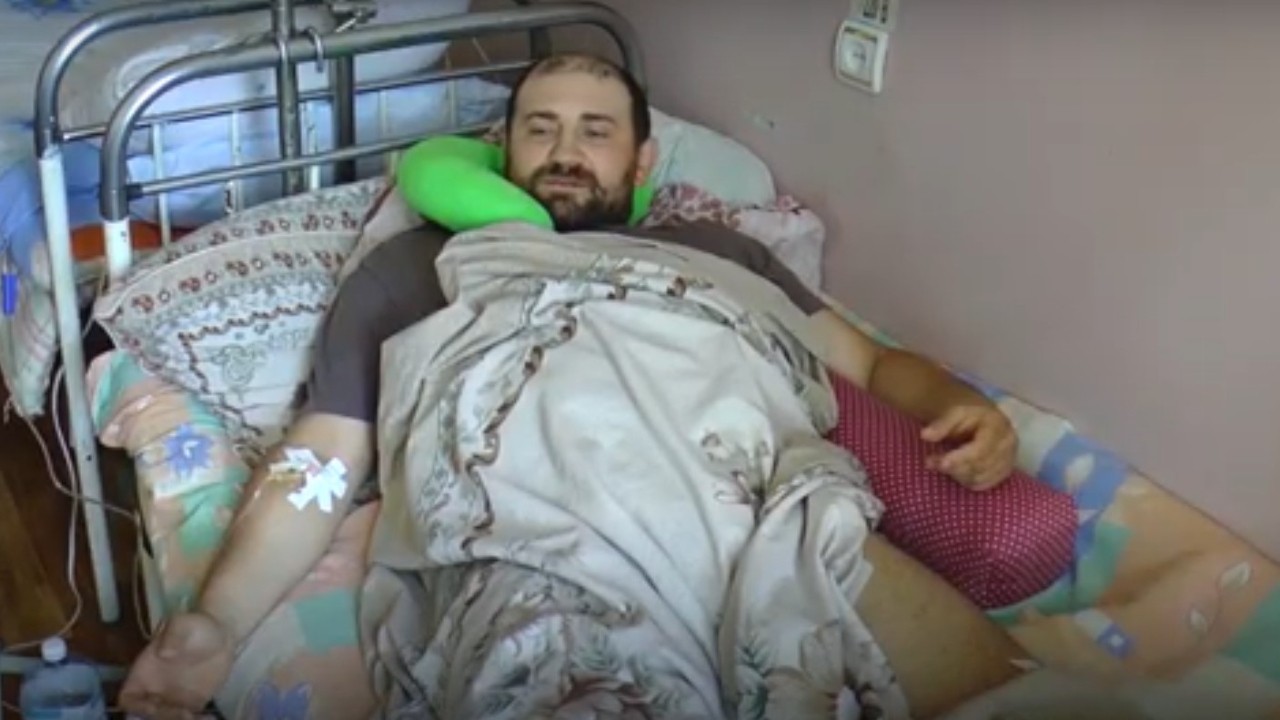Житель Авдіївки може залишитися інвалідом після двох пострілів у ногу